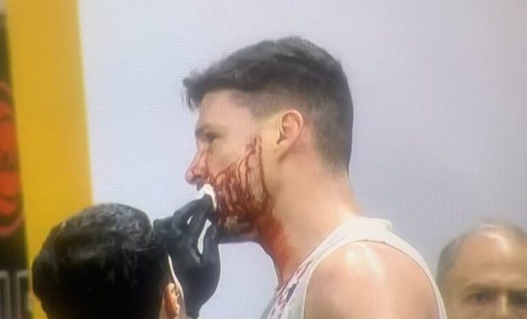 Por un corte en el rostro Alejandro Diez no pudo terminar el partido de Ferro ante Regatas